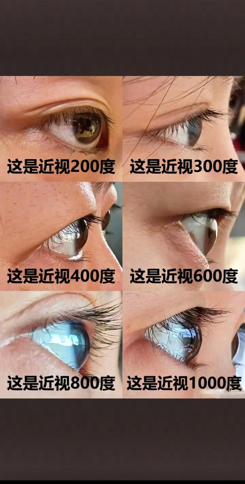 戴眼镜会让眼球变凸怎么预防？实用贴士快收藏！