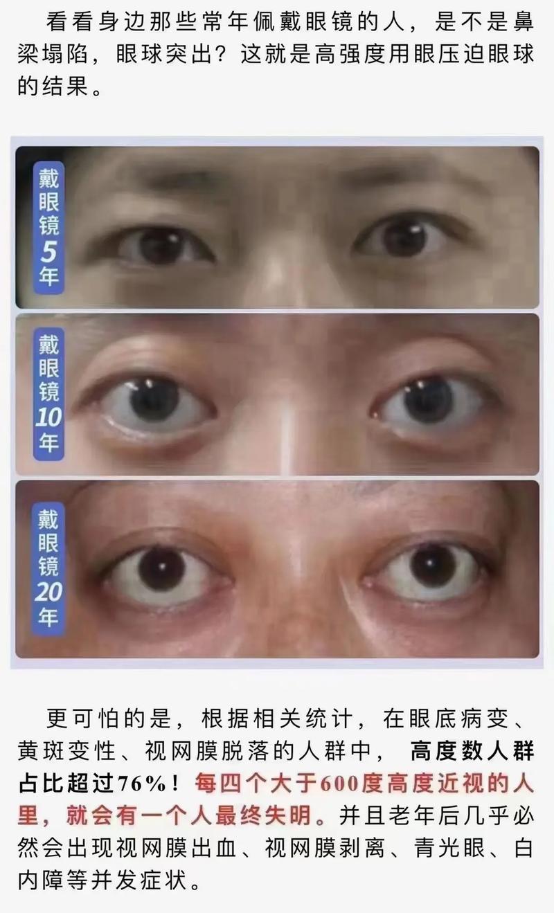 戴眼镜会让眼球变凸怎么预防？实用贴士快收藏！