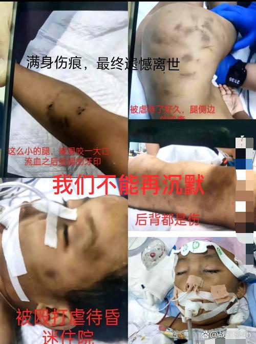 被摘除的外物后遗症有哪些？学会识别这些关键症状！