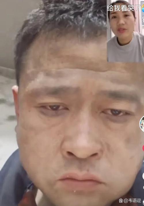 温州啃脸男真实原因是什么？专家分析背后真相揭露