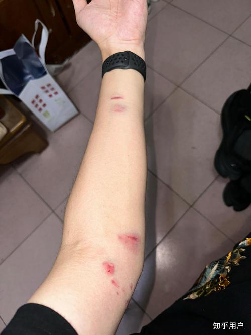我膝盖中了一箭现实版?长沙男子晾衣服遇惊险事件