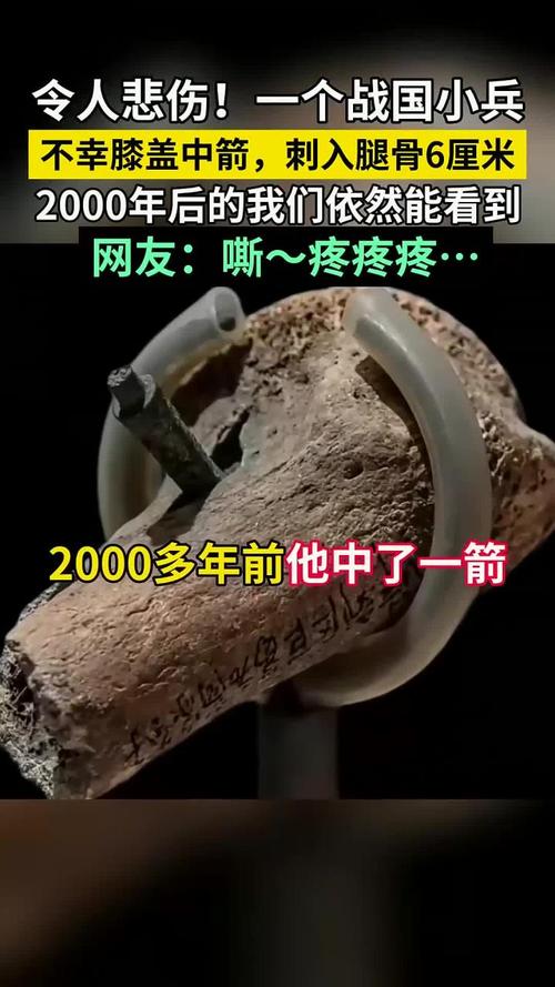 我膝盖中了一箭现实版?长沙男子晾衣服遇惊险事件