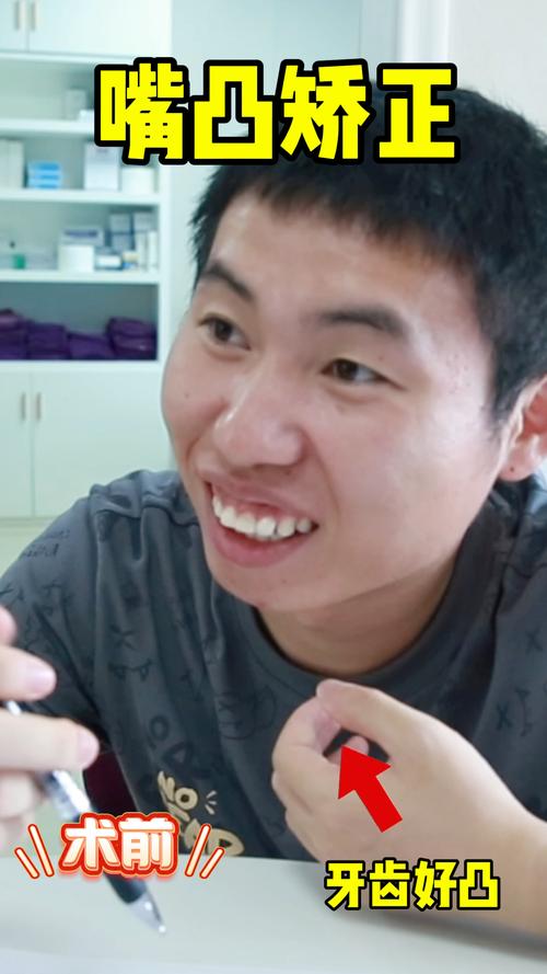 龅牙哥ps是什么？快速了解网络热梗全过程！