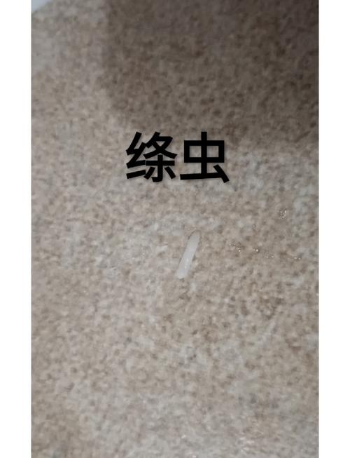 内部寄生虫最新：实用详细教程，帮助你轻松应对