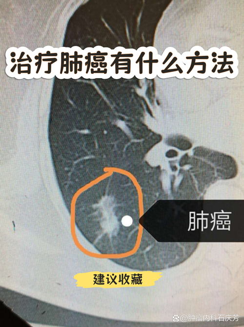 变异区汉化版下载：深入解析与用户体验提升
