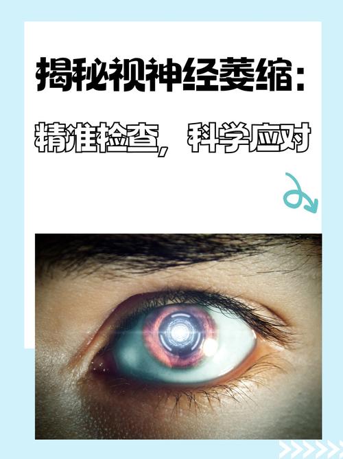 深度分析:视灵1在安卓平台的下载与发展潜力