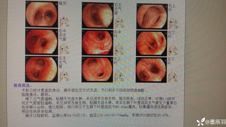 解析《传染危机V3.0汉化版》的魅力与挑战